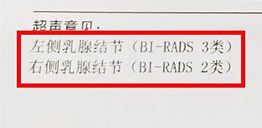 乳腺自查“一看、二摸、三擠”，每個女性都該掌握的自我保健法，中年女性每月必檢
