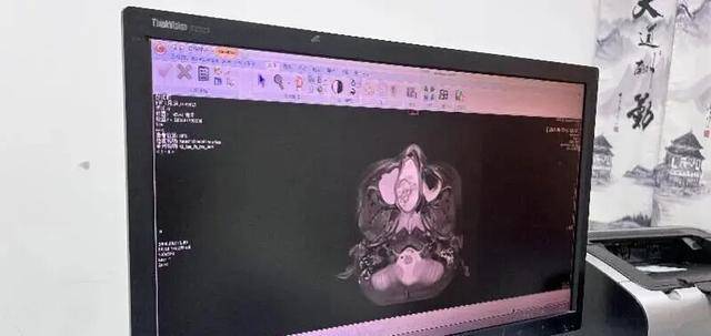 男童日本旅遊期間突發不適劇痛難忍，緊急回國確診罕見疾病